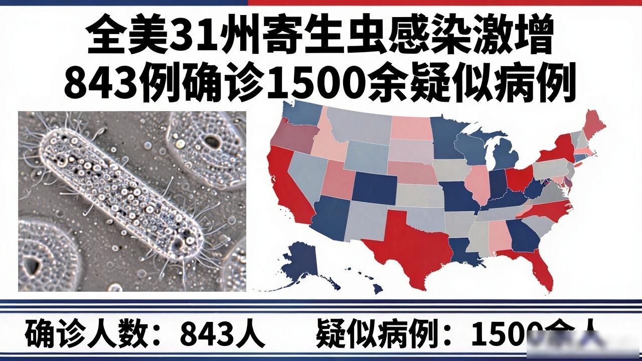 _美国寄生虫感染情况_全球寄生虫感染率国家排名